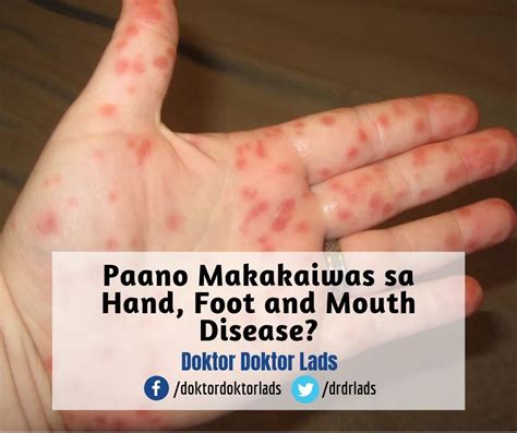 masakit paa in english